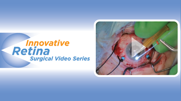 Innovative Retina Surgical Video Series