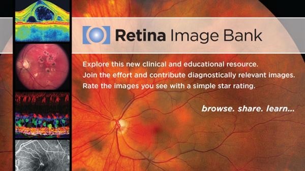 Retina Image Bank: Images of the Week